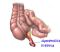 appendiceinfetta